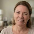 Understanding Facial Synkinesis Causes and Modern Treatment Approaches